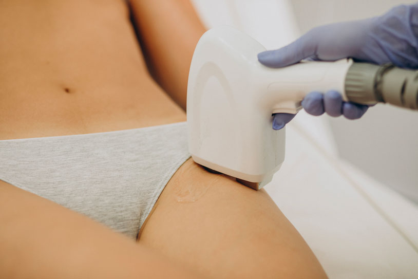 Epilazione laser epilation hair removal therapy